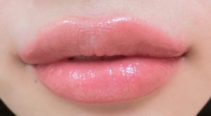 过敏性唇炎怎么办 6护理措施让你远离过敏性唇炎